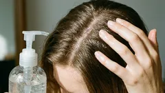 Miksi aloe veraa kannattaa käyttää hiuksiin ja mihin tätä luonnollista tuotetta suositellaan?